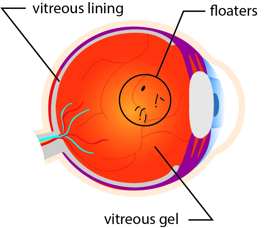Arc Light Flashes In The Eye Shelly Lighting